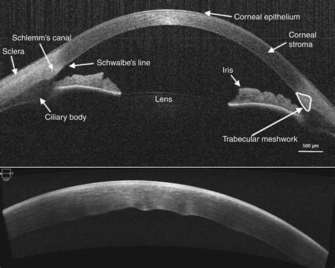 oct for anterior segment imaging